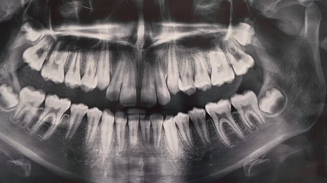 Doctor points to a panoramic X-ray (Orthopantomogram), discussing modern dentistry and orthodontic concept