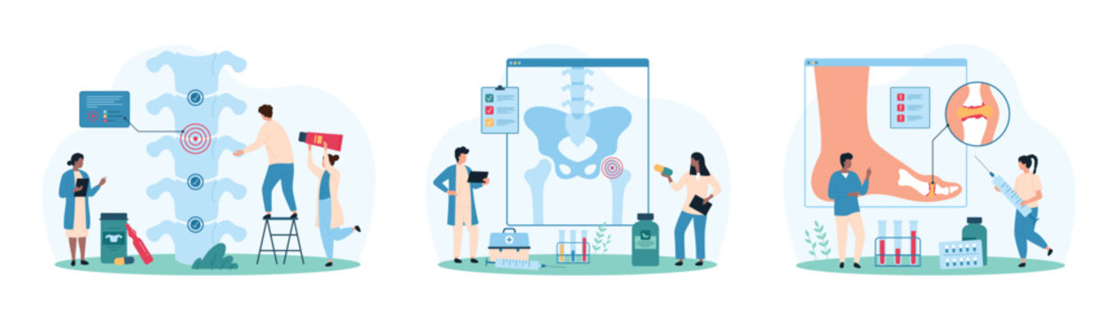 Chronic bone and ligament diseases, orthopedic diagnosis and treatment set. Tiny people examine xray of patients skeleton, hip joint and spine, ankle with inflammation cartoon vector illustration