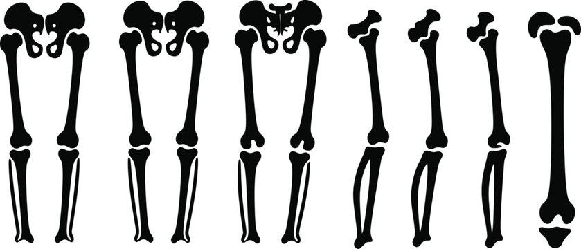 Set Of Human Leg Bones Alignment Vector Illustration