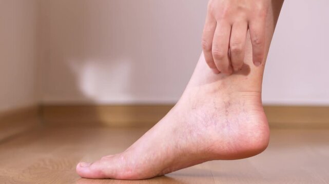 Close-up of woman carefully checking visible leg veins, feeling along skin surface to assess texture changes and early vascular concerns. Woman gently touching and palpating visible leg veins.