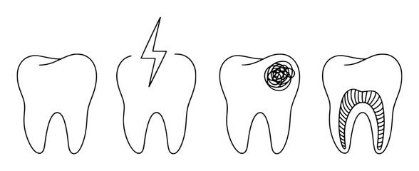 Dental Health Stages Healthy, Pain, Cavity, and Root Canal