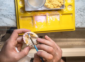 Dental crowns coated with primer before firing by technician in lab, prosthodontics process, ceramic preparation, oral restoration, dental manufacturing. Top view