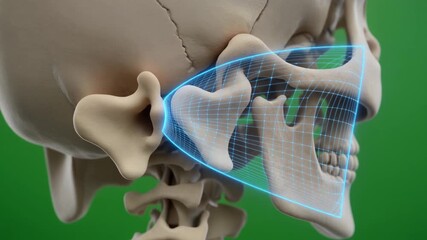 A 3D medical illustration of the human skull highlighting the temporomandibular joint with a blue digital grid overlay. - Powered by Adobe