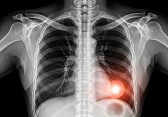 Medical illustration of stomach pain in human digestive system. 3d rendering of abdominal anatomy showing inflammation and disease. Gastroenterology concept with copy space