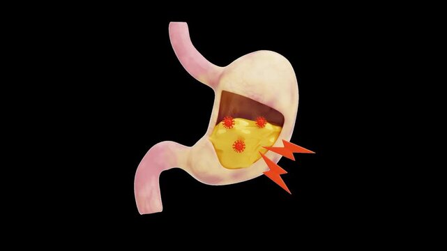 3D Stomach Pain | Alpha Channel