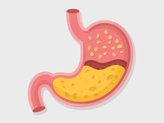 A colorful cartoon illustration of a human stomach, depicting anatomical features in a simplified way, useful for educational and health-related content.