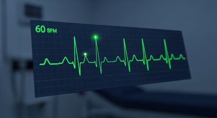 Visual representation of heart activity displayed on an electronic monitor in a clinical setting