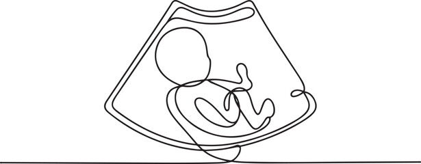 Continuous line design of baby ultrasound results. one line Icon drawing with white background