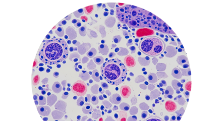 Bright clinical smear balanced smooth transparency