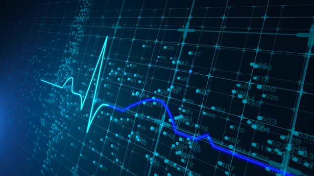 EEG digital waveform scan shows electrical brain conductivity display
