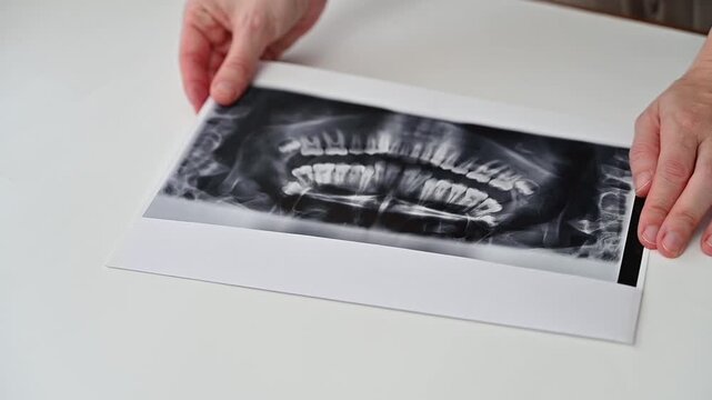 Professional dentist examining OPG panoramic X-ray images, planning orthodontic or restorative treatment