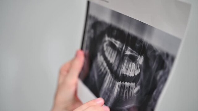 Professional dentist examining OPG panoramic X-ray images, planning orthodontic or restorative treatment