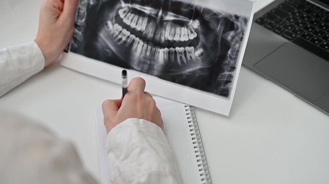 Dentist showing a patient a panoramic dental X-ray (OPG) for diagnosis and treatment planning. Modern dentistry concept