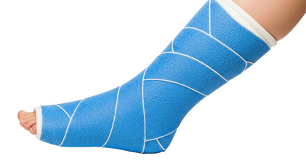 Person's leg in a bright blue orthopedic cast. cutout on transparent background