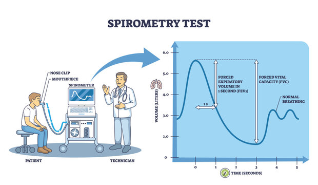 Spirometry test brief diagram showing patient with mouthpiece, spirometer monitor, and FEV1-FVC curve explaining lung function assessment. Outline diagram