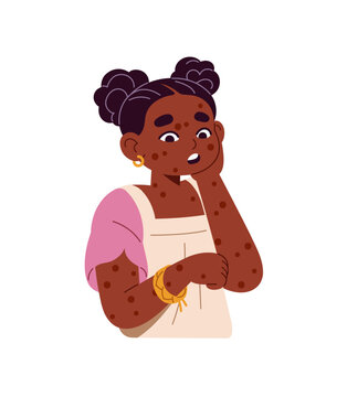 Black little girl with rash on body, chickenpox. Ill kid with chicken pox, allergic spots on skin. Sick child with measles, smallpox virus. Flat isolated vector illustration on white background