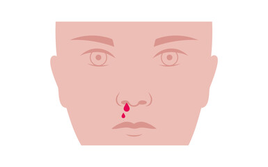 Nosebleed medical poster