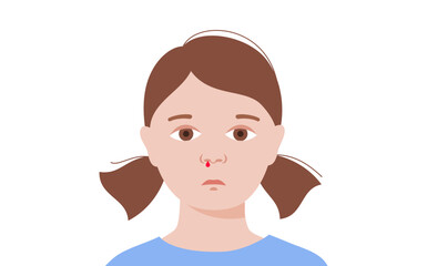 Nosebleed medical poster