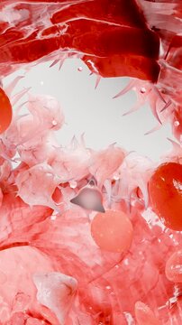 Hemostasis. Red blood cells and platelets in the blood vessel, vasoconstriction, wound healing process. hemorrhage clot embolisms, Hemophilia. fibrinolysis, injury bleeding coagulation, 3d render