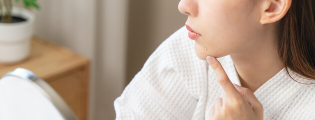 Asian young woman looking face skin in the mirror have a red rash on her face from cosmetic allergy