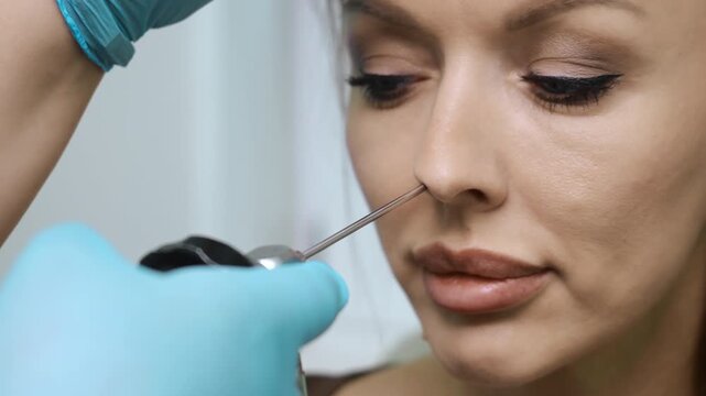 Close up of ENT doctor performing nasal endoscopy on a female patient during medical examination. Professional otolaryngology procedure with endoscope in clinic environment.