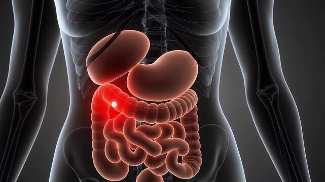 human body with intestines and stomach inflammation. Illustration of gastritis displaying discomfort, nausea, and digestive issues