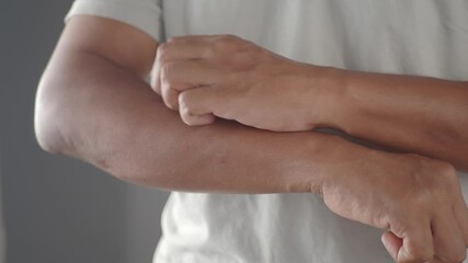 Itching relief techniques for dry skin discomfort