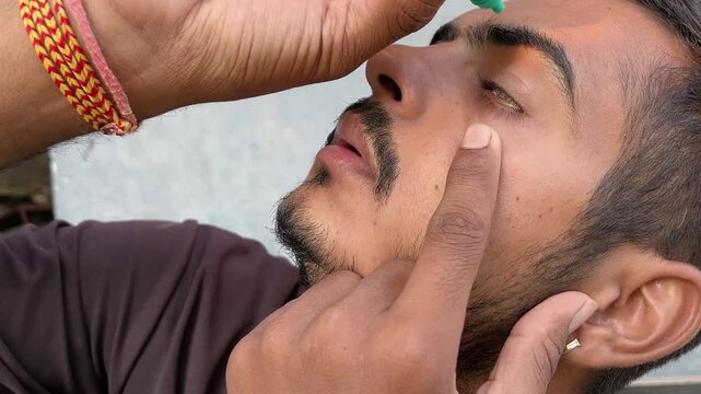 Boy Applying Eye Drops Close-Up for Eye Care in 4K