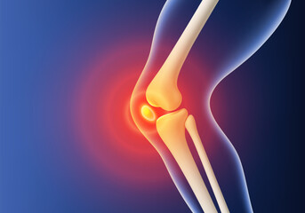 3D knee pain visualization. Leg bones with red inflammation glow at joint area. Biological and medical concept. Vector illustration