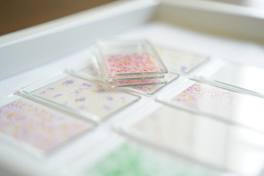 Laboratory slides showing stained cell samples arranged on a clean bench.