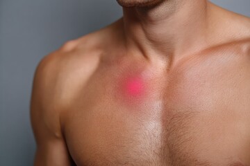 Dermatological Red Mark on Male Chest Indicating Skin Problem