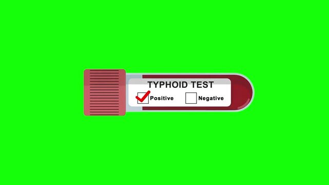 Typhoid test tube positive result animation on a green screen background for medical diagnostics, bacterial infection screening and laboratory presentations