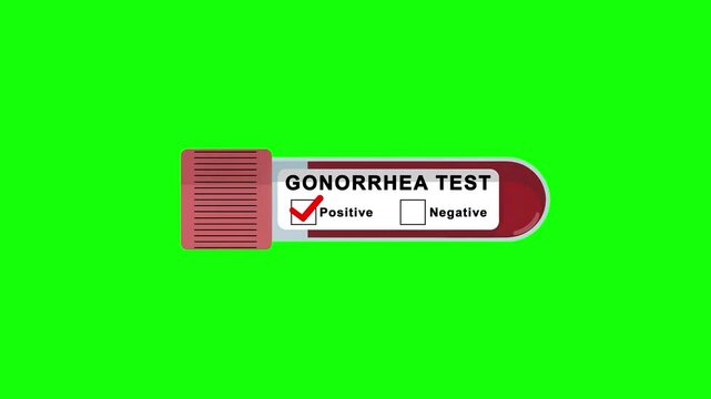 Gonorrhea test tube positive result animation on a green screen background for medical diagnostics, infection screening and laboratory presentations