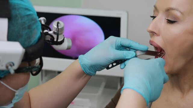 Close up of ENT doctor performing oral endoscopy examination with medical endoscope. Patient opens mouth during procedure in modern healthcare clinic, diagnostic check under bright light.