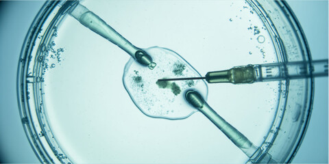 In Vitro Fertilization (IVF) under Microscope