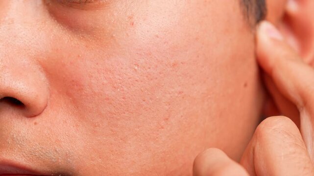 Gently massaging the cheekbone from nose to ear helps reduce sinus pressure and congestion, symbolizing relaxation, clarity, improved circulation, balance, relief, wellness, and mindful self-care.
