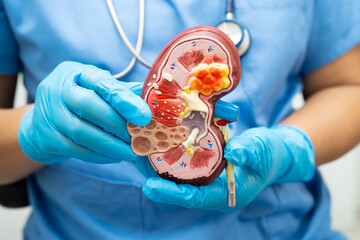 Chronic kidney disease, doctor with model for treatment urinary system, urology, Estimated glomerular filtration rate eGFR.