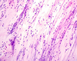 Sputum smear