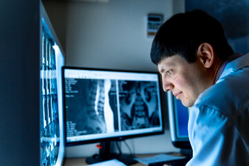 Doctor analyzing spine scans on monitors. Physician reviews spinal medical images on dual screens...