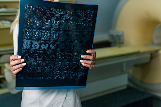 Technician holding MRI film in room. Medical worker displays MRI sheet beside large imaging scanner inside medfacility