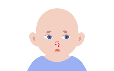 Nosebleed medical poster