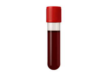 Blood sample in test tube for medical analysis