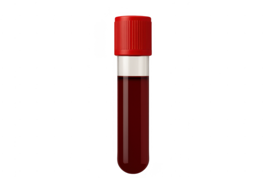 Blood sample in test tube for medical analysis