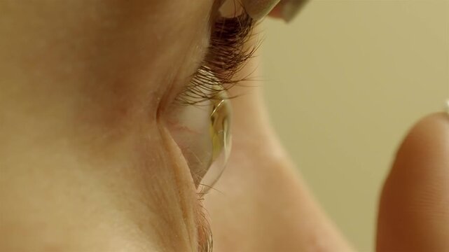 Failed attempt: woman struggles placing contact lens in her eye