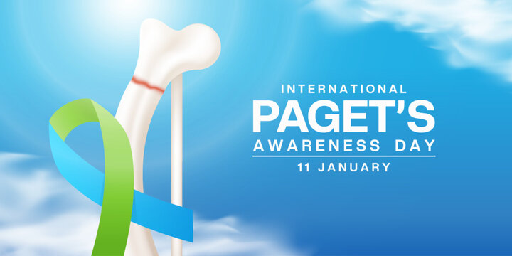 January 11 is International Pagets Awareness Day. Ribbon, bone, cloud and sun. Great for cards, banners, posters, social media and more. Blue background.   