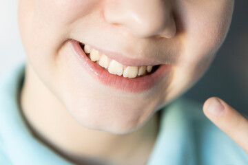 Child showing off a big smile with a missing tooth in a cheerful moment at home