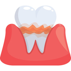 Close Up of a Diseased Tooth With Red Gums Showing Plaque Buildup and Gingivitis Affecting Dental Health Transparent Background