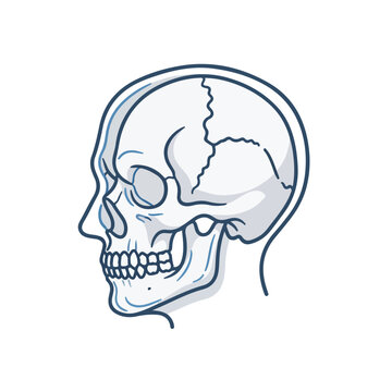 Illustration of a human skull with a fracture line drawn in blue on a white background.