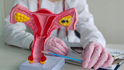 Demonstration and analysis of the female reproductive system anatomy model. Cytological diagnosis of cervical diseases concept