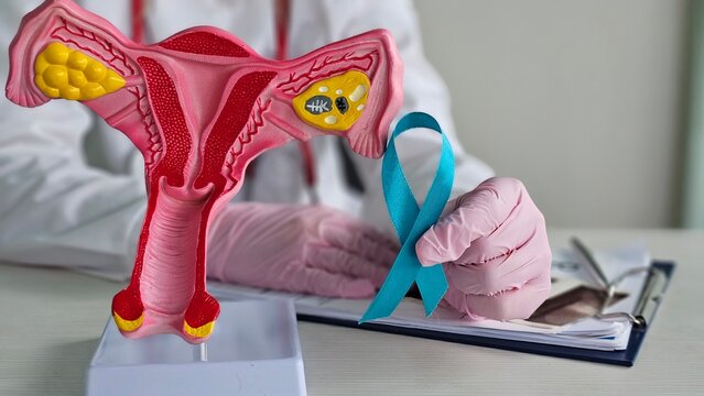 A doctor holds a turquoise ribbon with a model of the uterus and ovaries in honor of Cervical Cancer Awareness Month in January